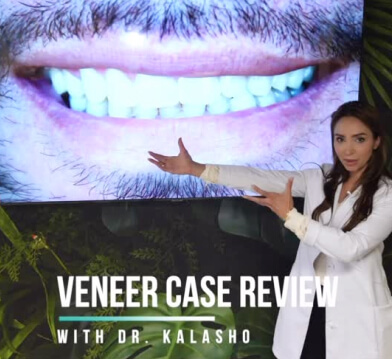 Dr Rhonda Kalasho points to a large screen displaying a close-up of a mouth with veneers, labeled "Veneer Case Review."