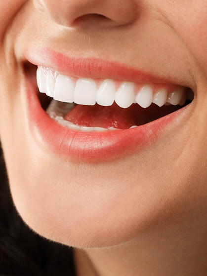 Close-up of a person smiling widely, showing perfectly white, straight upper teeth and pink lips.
