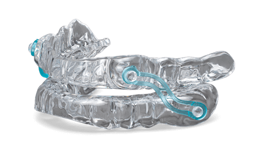 Clear, custom-fitted braces with a blue connector strap shown against a black background.